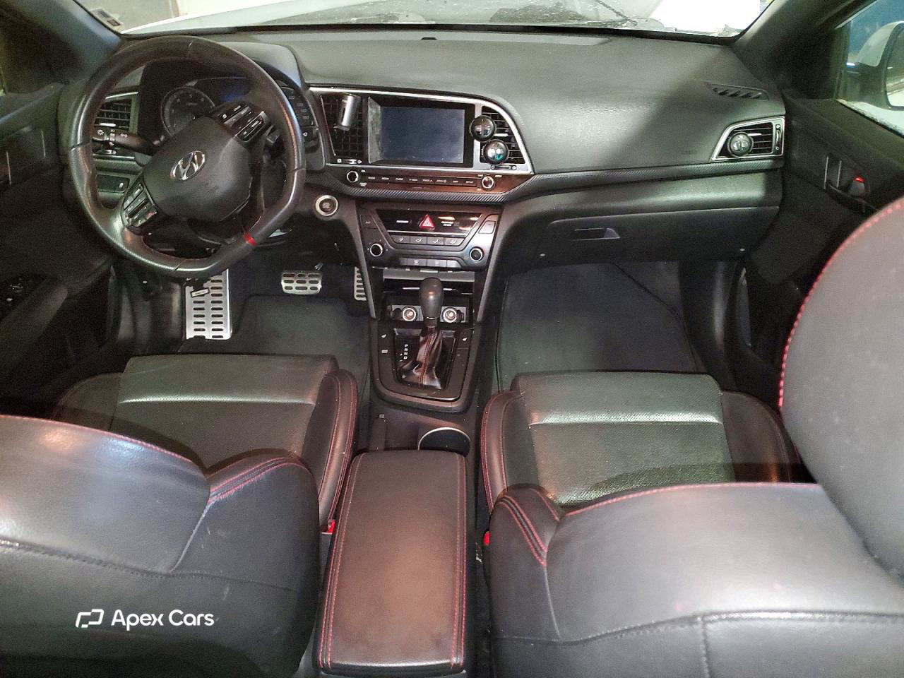 Hyundai Elantra 2017