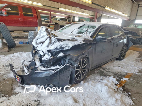 Acura TLX 2015 - Image 1 of 13