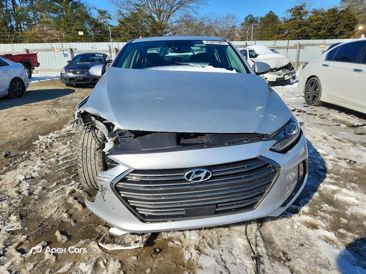 Hyundai Elantra 2017