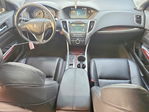 Acura TLX 2015
