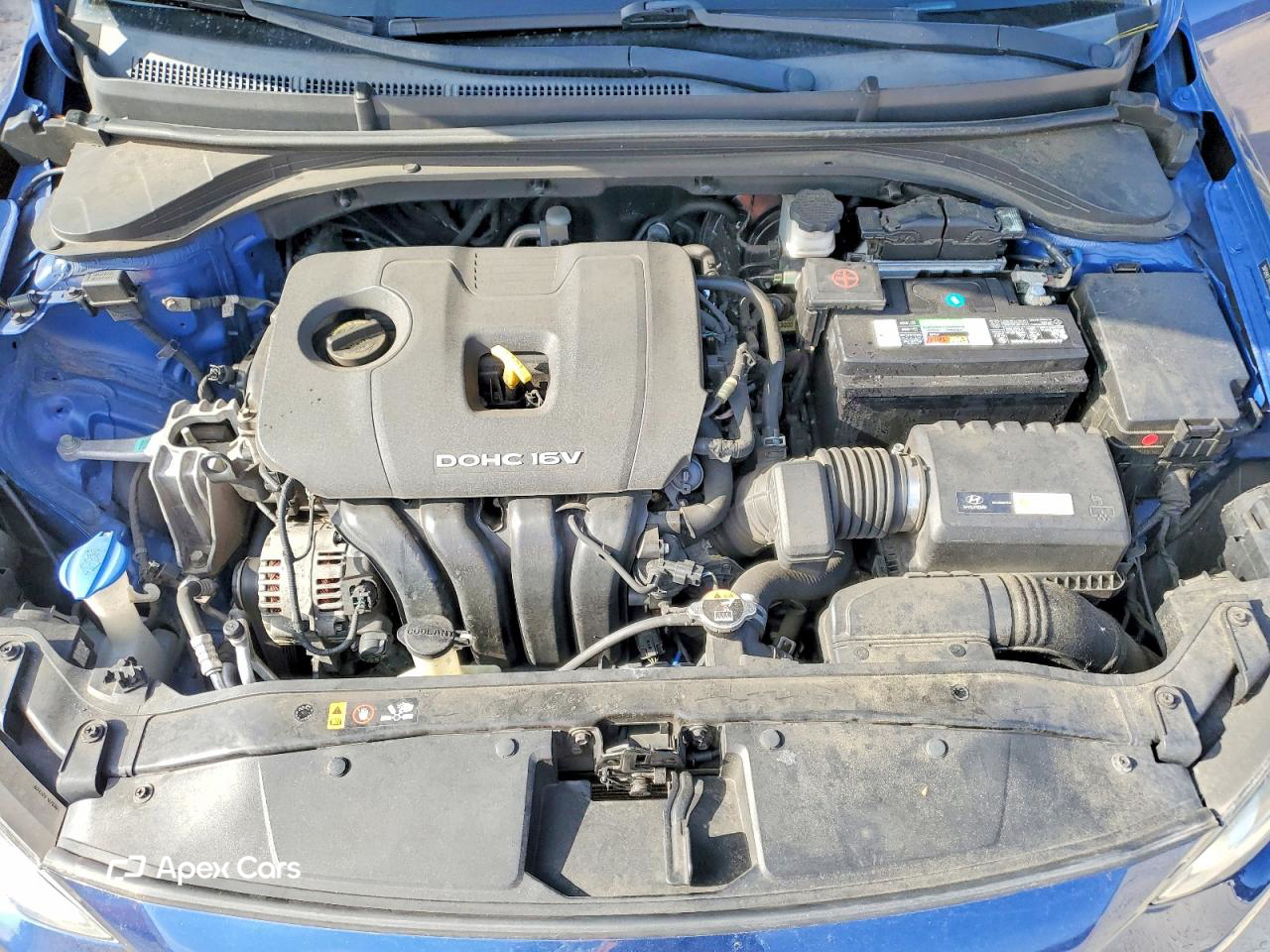 Hyundai Elantra 2017
