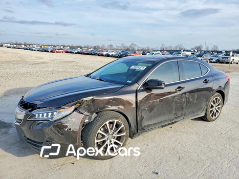 Acura TLX 2017 - Image 1 of 13