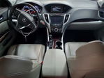 Acura TLX 2016