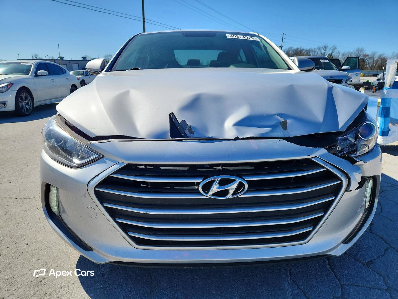 Hyundai Elantra 2017
