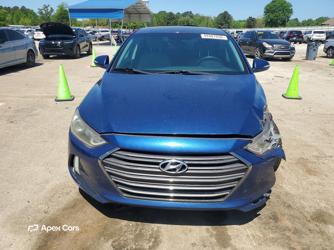 Hyundai Elantra 2017