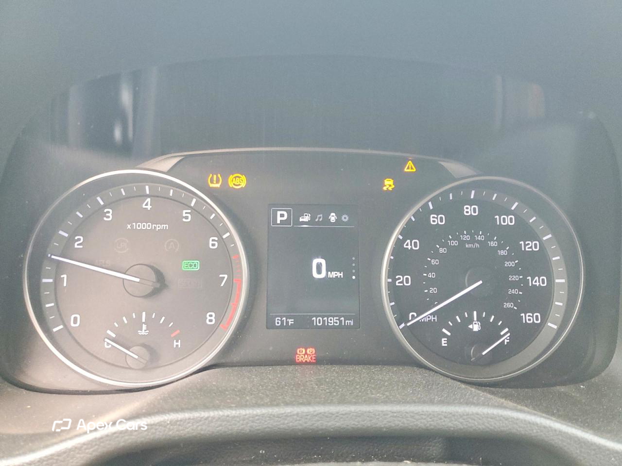 Hyundai Elantra 2017