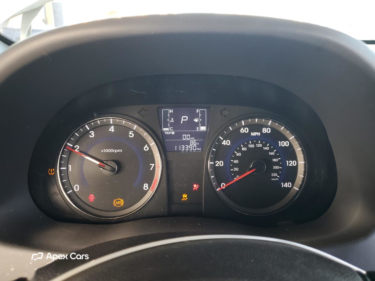 Hyundai Accent 2016