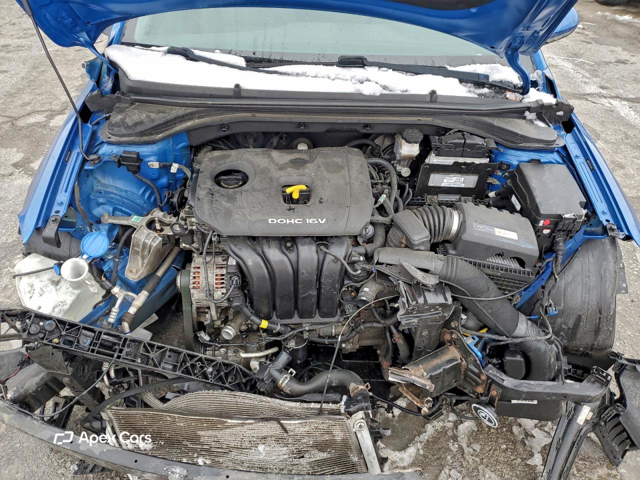 Hyundai Elantra 2017