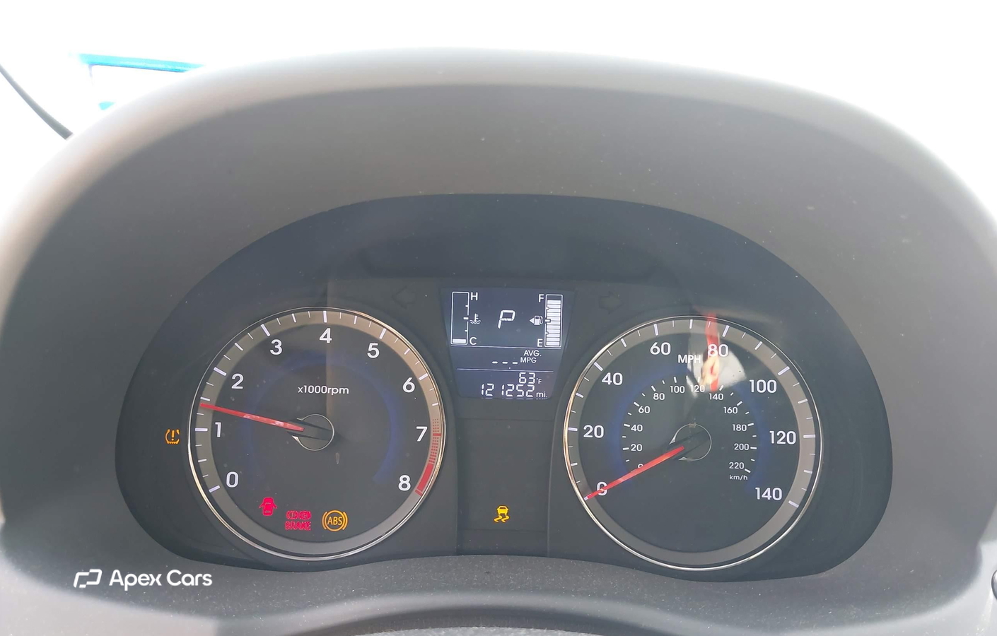 Hyundai Accent 2017